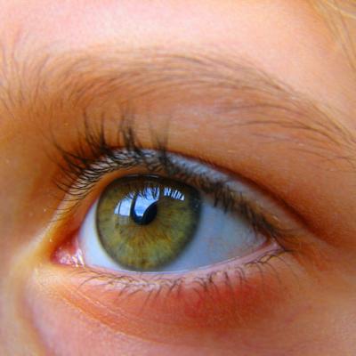دام برس : دام برس | انحراف البصر يؤدي إلى العمى بشكل تدريجي