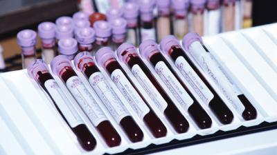 دام برس : دام برس | العلماء يحصلون على الدم من الخلايا الجذعية