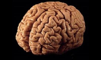 دام برس : حجم المخّ يتأثّر بالاضطرابات النفسية