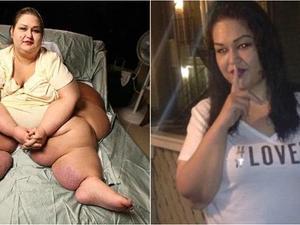 دام برس : دام برس | فقدت 350 كيلو من وزنها بعد أن خنقت ابن شقيقتها