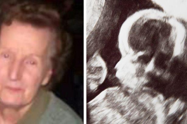 دام برس : دام برس | بالصور: إيرلندية وجدت وجه جدتها المتوفاة في صورة لجنينها