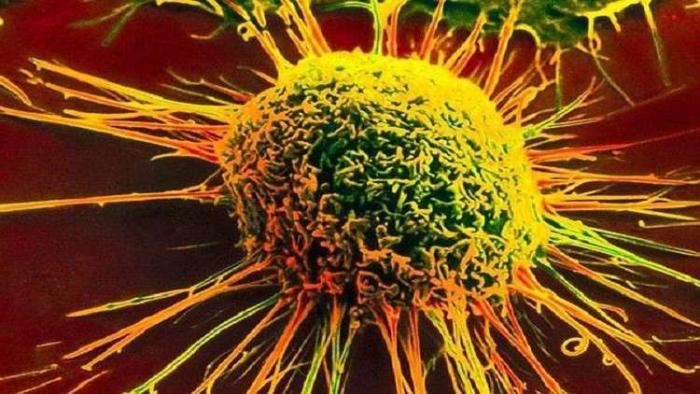 دام برس : كيف تتنصر الخلايا السرطانية في معركة البقاء ؟