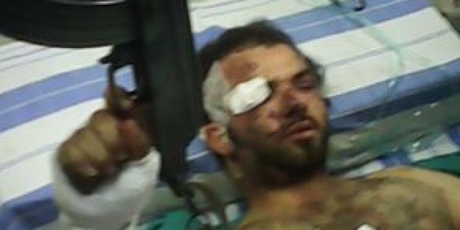 دام برس : هؤلاء هم حماة الديار .. صورة لجندي سوري مصاب في كسب يرفض ترك سلاحه
